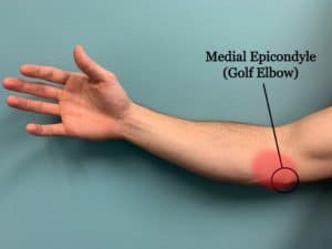 golf elbow