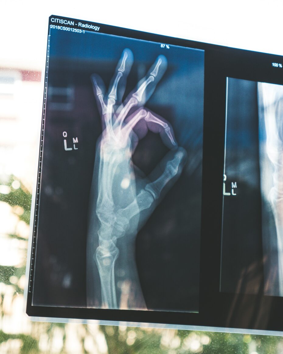 An xray of a hand holding the OK sign.